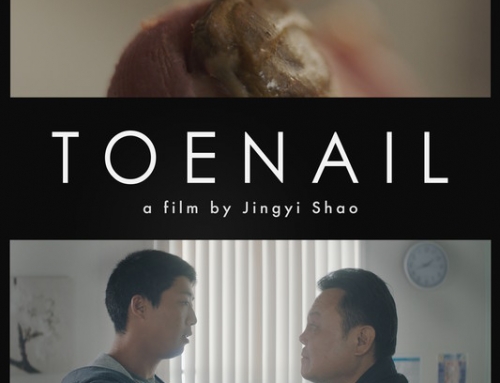 Toenail